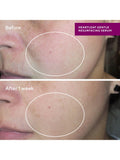 Murad Heartleaf Gentle Resurfacing Serum 30ml, imported from the UK
