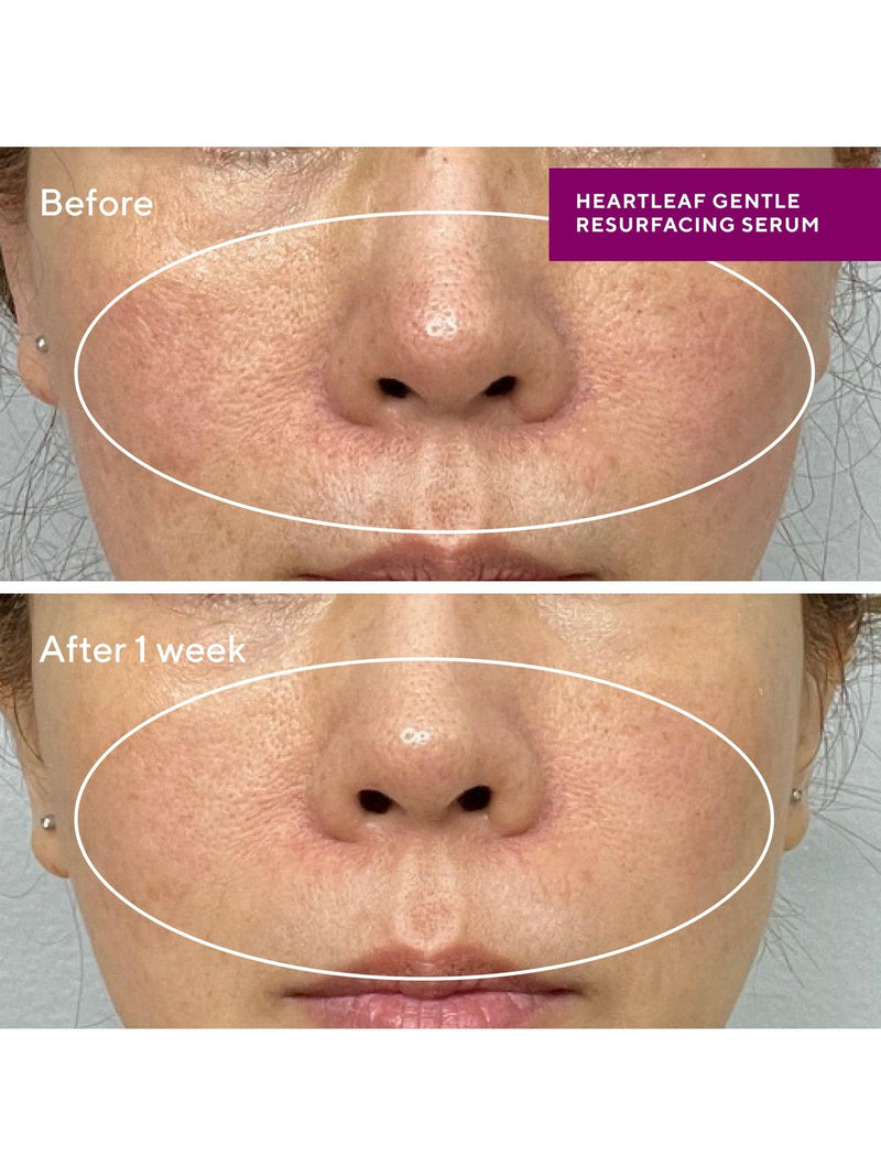 Murad Heartleaf Gentle Resurfacing Serum 30ml, imported from the UK