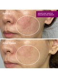 Murad Heartleaf Gentle Resurfacing Serum 30ml, imported from the UK