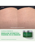 Murad Retinal ReSculpt body treatment 148ml, UK version