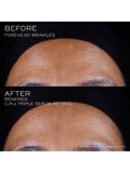 Lancôme Rénergie C.R.X Triple Serum Retinol, UK version