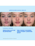 Murad blemish treatment serum 30ml, UK version