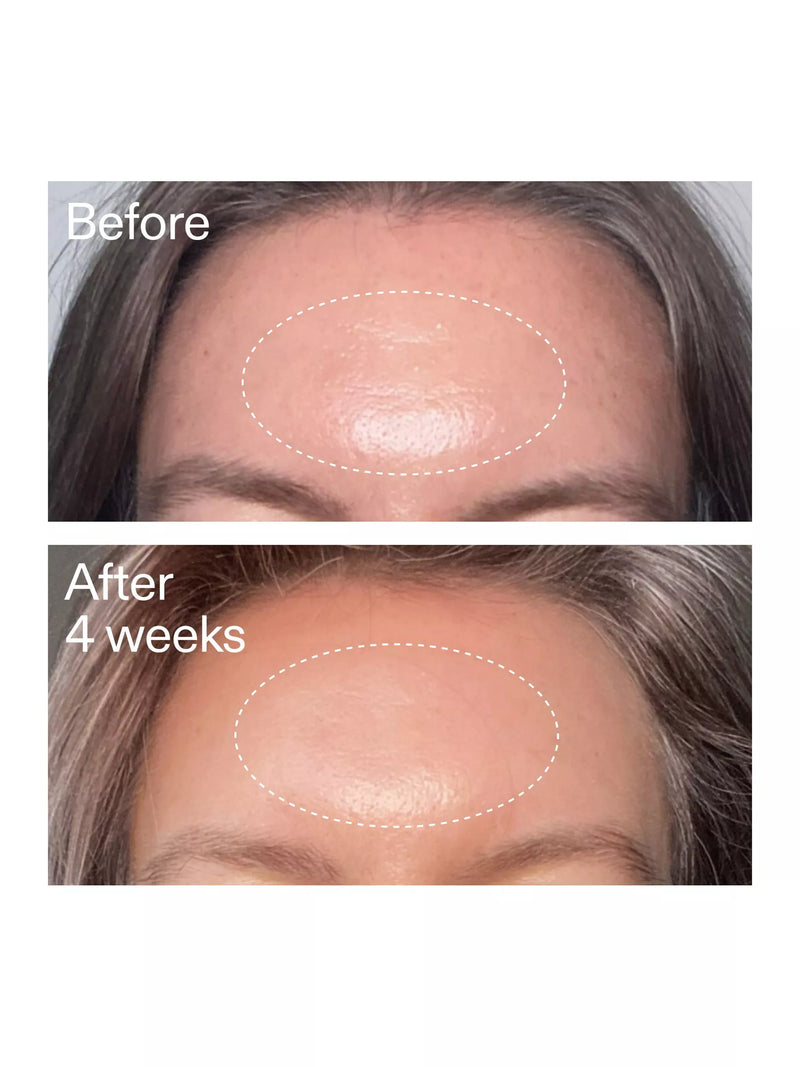 The INKEY List Advance Retinal Serum 15ml, UK version