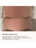 The Light Salon Boost LED Mask device, imported from the UK