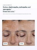 Skin Rocks hyperpigmentation serum refill 30ml, UK version