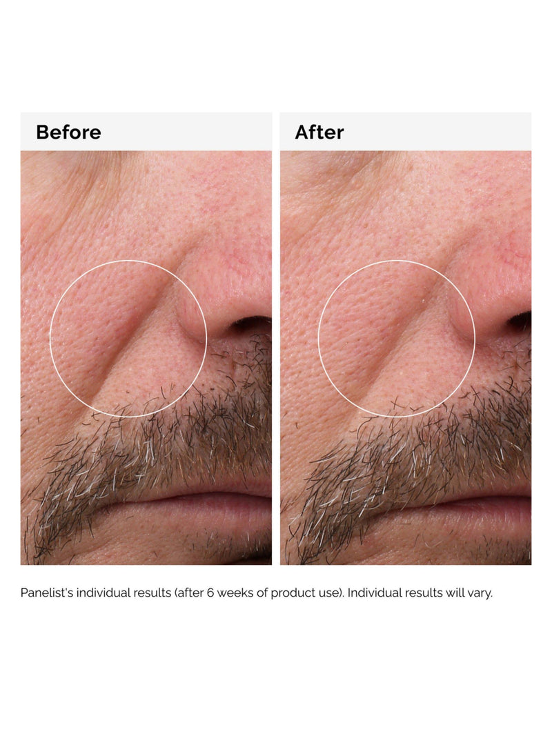 The Ordinary fermented rosehip seed oil 30ml, UK version