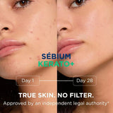 Bioderma Sebium Kerato+ gel cream 30ml - British product