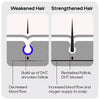 Sons Minoxidil hair regrowth solution 5% (British brand)