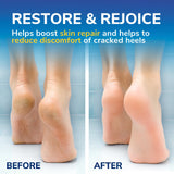 Scholl cracked heel cream balm 60ml, UK version