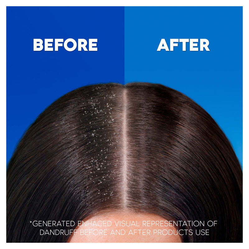 Head and Shoulders Classic Clean 2in1 anti-dandruff shampoo and conditioner 2 x 1L, UK version