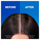 Head and Shoulders Classic Clean 2in1 anti-dandruff shampoo and conditioner 2 x 1L, UK version