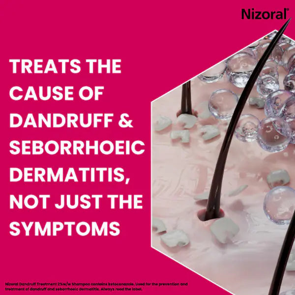 Nizoral dandruff treatment shampoo Ketoconazole 2%, imported from the UK