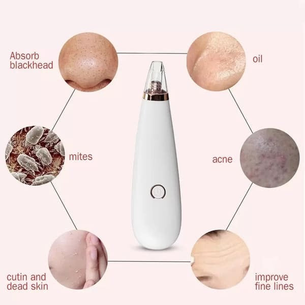 ErthSkin pore vacuum blackhead remover, imported from the UK