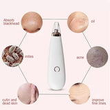 ErthSkin pore vacuum blackhead remover, imported from the UK