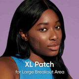 Skin Choice Bacne XL Pimple Patches 10pcs (British brand)