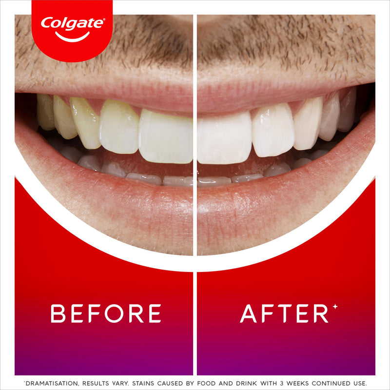 Colgate Max White overnight teeth whitening serum 2.5ml - British product