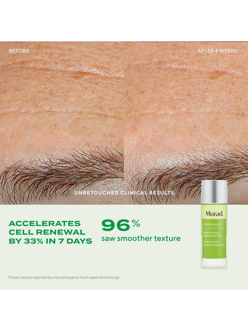 Murad Resurgence Multi-Acid Peel 100ml (British brand)