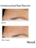 Murad Resurgence Multi-Acid Peel 100ml (British brand)