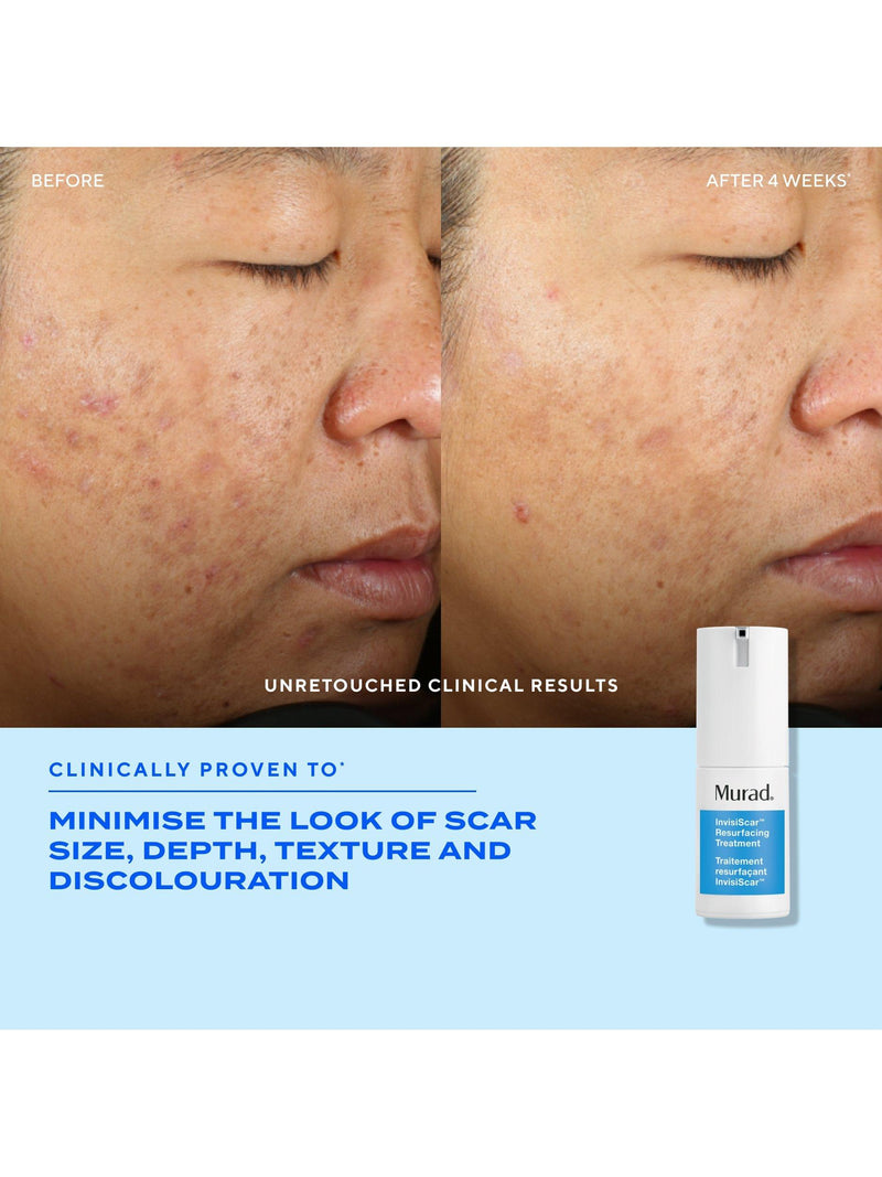 Murad InvisiScar resurfacing treatment 15ml (British brand)