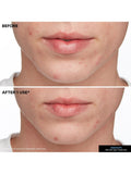 Kate Somerville EradiKate Blemish Treatment 30ml - British product