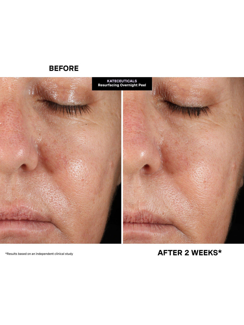 Kate Somerville resurfacing overnight peel 30ml, UK version