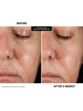 Kate Somerville resurfacing overnight peel 30ml, UK version