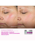 Murad Intense Recovery Cream 50ml skincare (British brand)