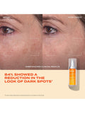 Murad Rapid Dark Spot Correcting Serum 30ml, imported from the UK