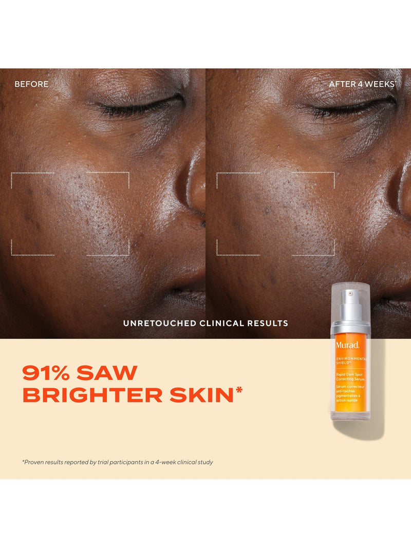 Murad Rapid Dark Spot Correcting Serum 30ml, imported from the UK