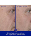 Augustinus Bader Serum Refill 30ml, imported from the UK