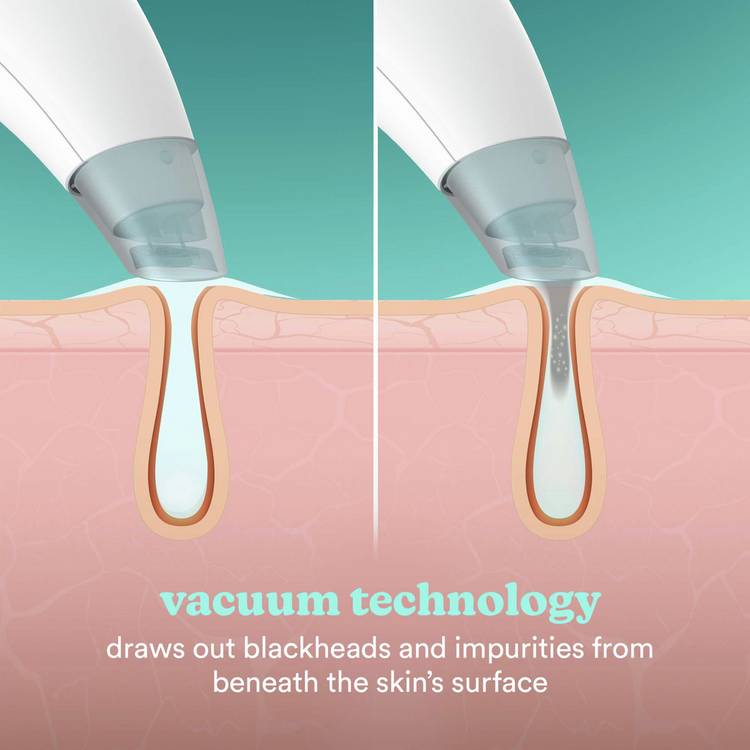 HoMedics Refresh Hydra Facial hydradermabrasion tool - British product