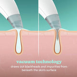 HoMedics Refresh Hydra Facial hydradermabrasion tool - British product