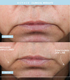 NuFACE Trinity+ Eye and Lip Set microcurrent device, UK version