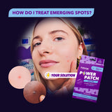 Purifide invisible blemish patches 36 count, imported from the UK