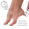 Rio Go Smooth foot file hard skin remover - British product