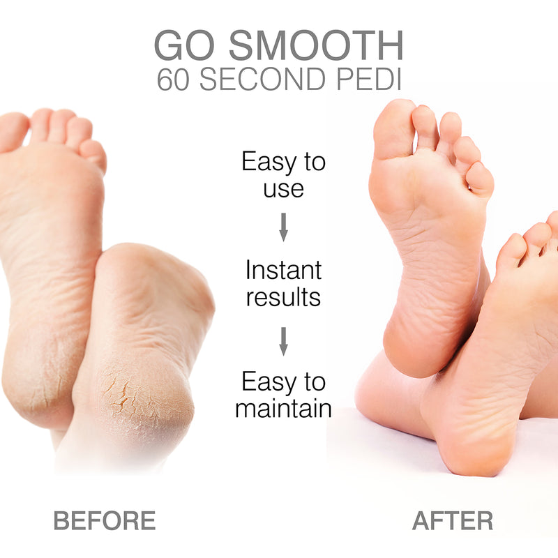 Rio Go Smooth foot file hard skin remover - British product