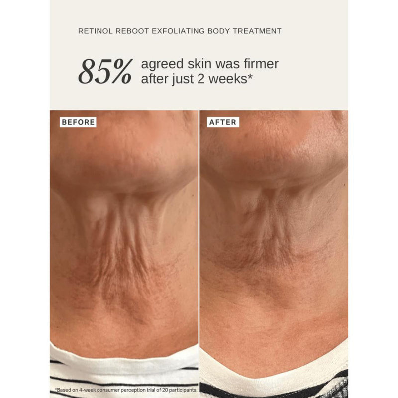 Alpha-H Retinol Reboot Exfoliating Body Treatment 120ml - British product
