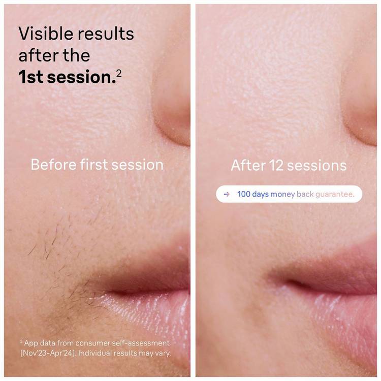 Braun Skin i-expert IPL hair removal device, imported from the UK