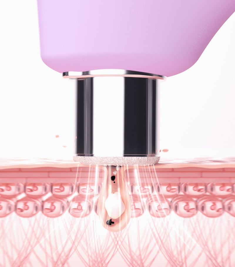 Foreo Kiwi Derma microdermabrasion and pore vacuum device, imported from the UK