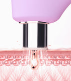 Foreo Kiwi Derma microdermabrasion and pore vacuum device, imported from the UK