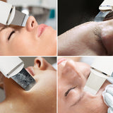 Rio Ultrasonic Facial Skin Cleanser, imported from the UK