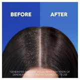 Head & Shoulders Anti Hair Fall Shampoo GOODS Superdrug   