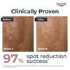 Eucerin Anti-Pigment Dual Face Serum 30ml - British product