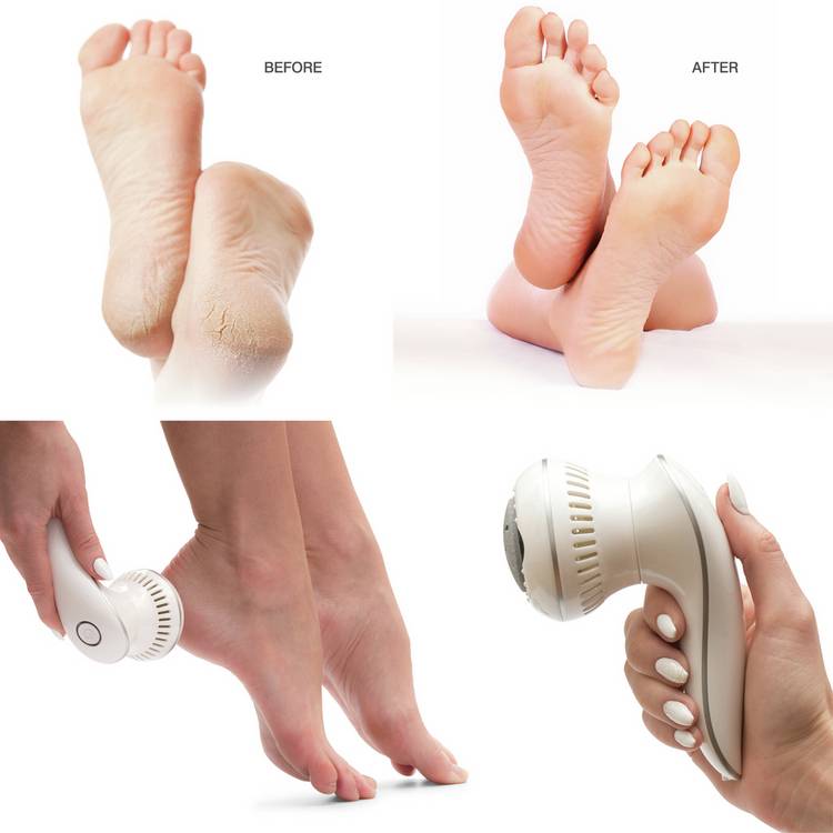 Rio Spa electric foot file with 3 grit heads (British brand)