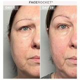 MAGNITON FaceRocket 5-in-1 facial massager - British product