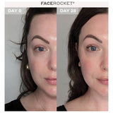 MAGNITON FaceRocket 5-in-1 facial massager - British product
