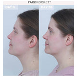 MAGNITON FaceRocket 5-in-1 facial massager - British product