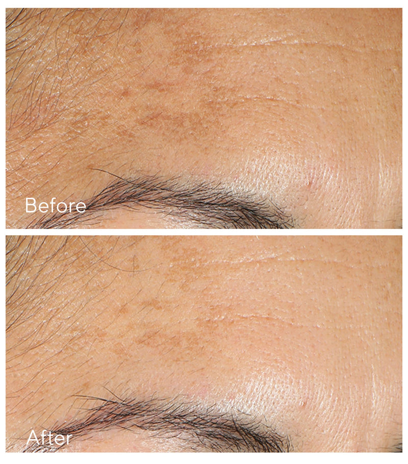 Murad Vita C Glycolic Serum 30ml, imported from the UK