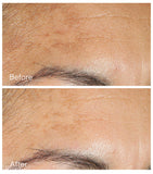Murad Vita C Glycolic Serum 30ml, imported from the UK