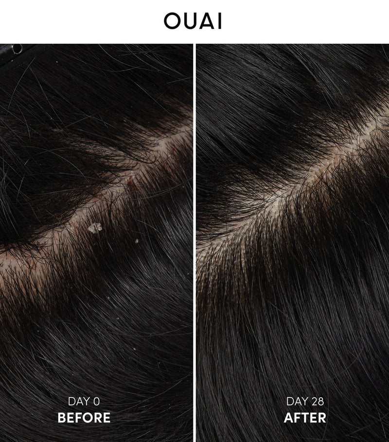 Ouai Anti-Dandruff Shampoo 300ml, UK version